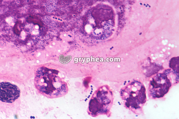 Phagocytose x400 - gryphea.org